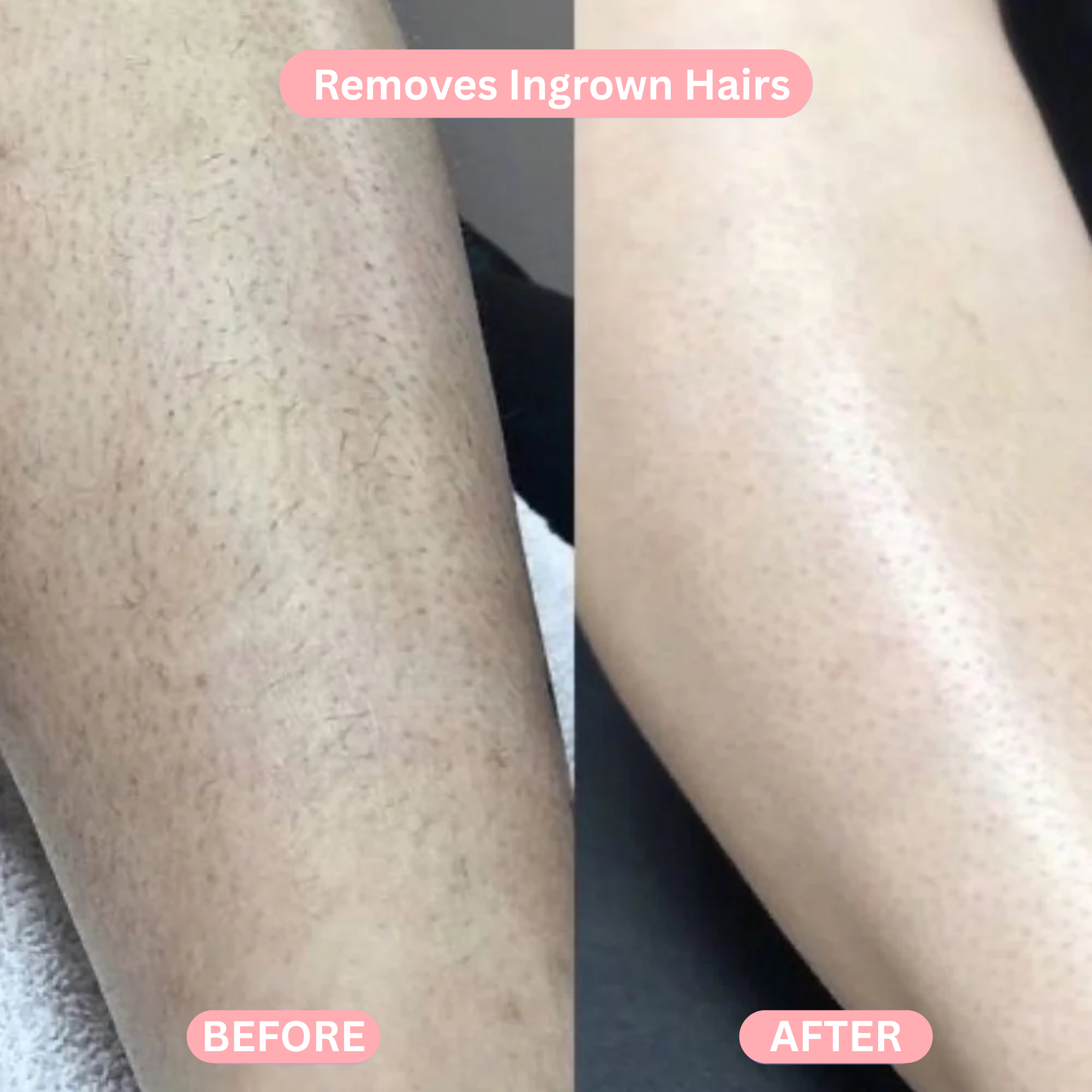The Tenzo Trimmer